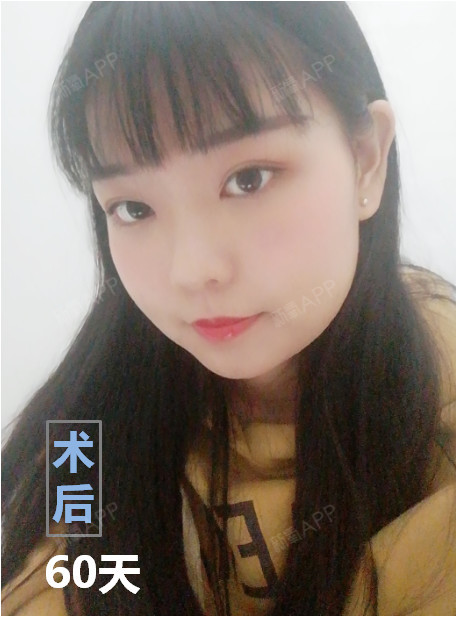 女生角抽烟让下颌下垂松弛?现在流行小V整形皮肤群图片