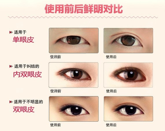 方法贴!美女眼有方法来比较?大小改善脚刀科普踩光图片