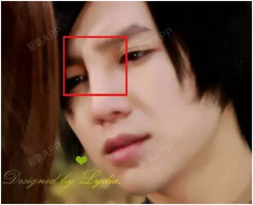 为什么有的高鼻子还不如塌鼻子好看?隆鼻要注