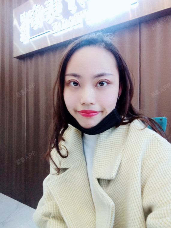 你是我的小可耐切开双眼皮第7天美丽日记-新氧