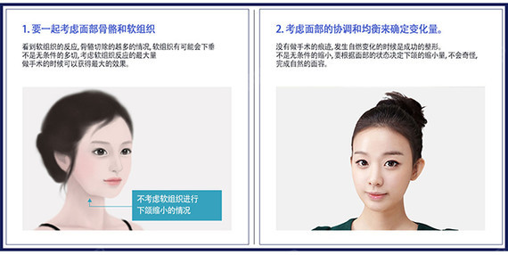 【菲斯莱茵整形faceline】年轻，漂亮下巴的条件=修饰的下颚body_圈子-新氧美容整形
