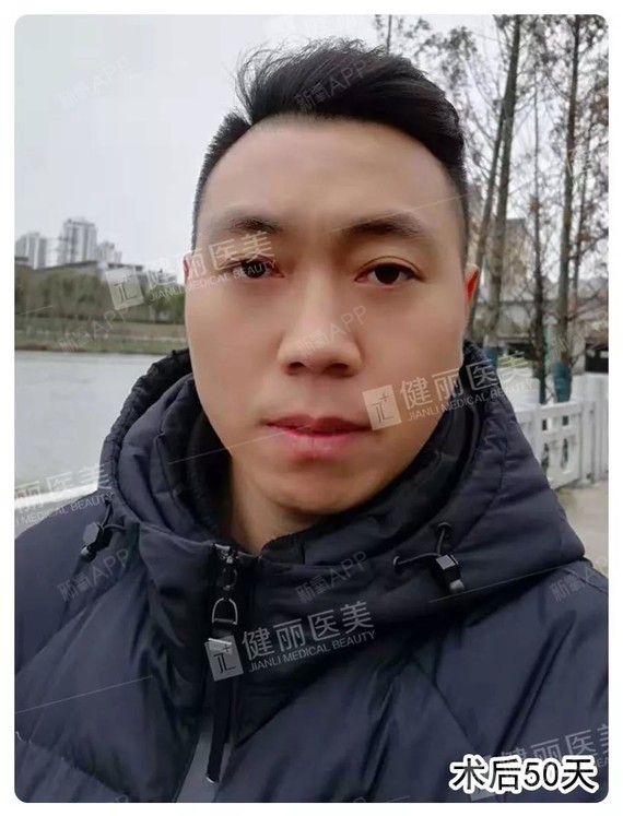 李先生在一家大型企业担任高管。由于工作压力