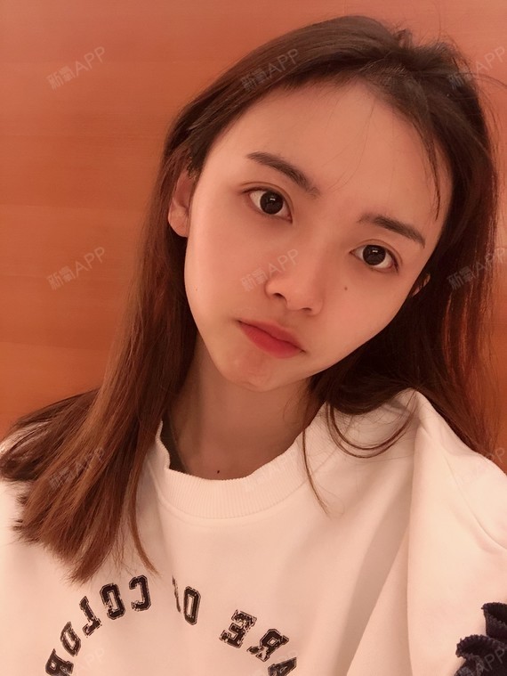 精髓的丽日二次元的害羞表情包中切开1双眼皮第58天美表情记-新氧图片