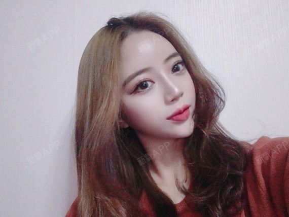 忑忑忐忐鼻综合第98天美丽日记-新氧美容整形