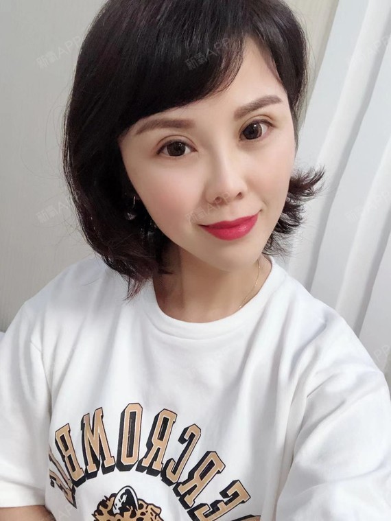 天空之墙眼部修复第40天美丽日记-新氧美容整