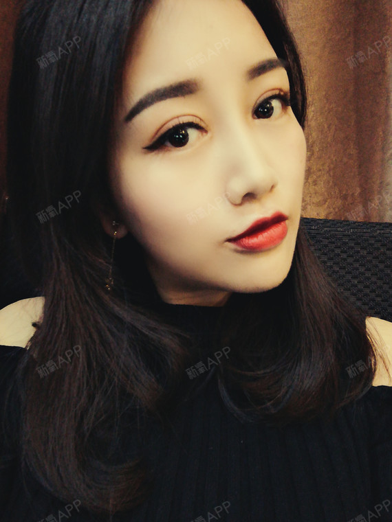 黎明前割个双眼皮切开双眼皮第131天美丽日记