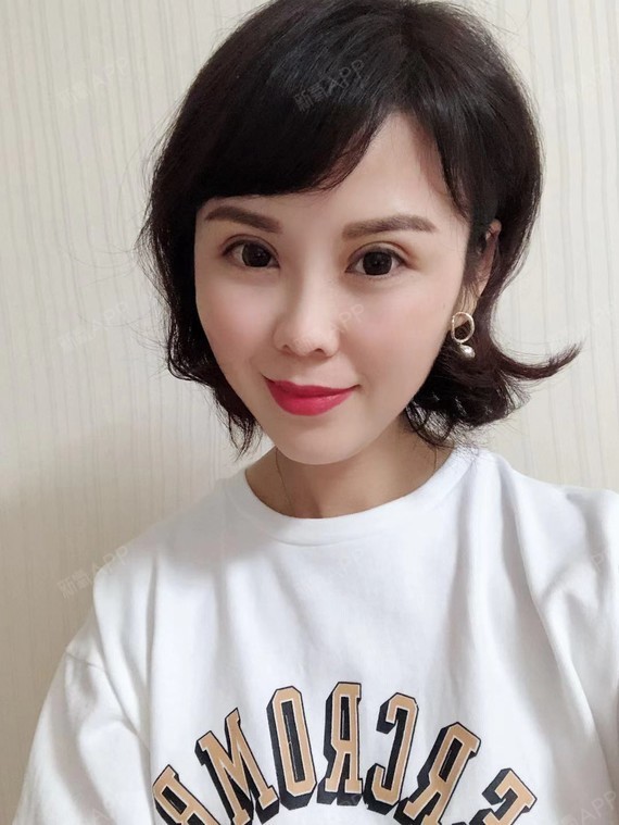 天空之墙眼部修复第40天美丽日记-新氧美容整