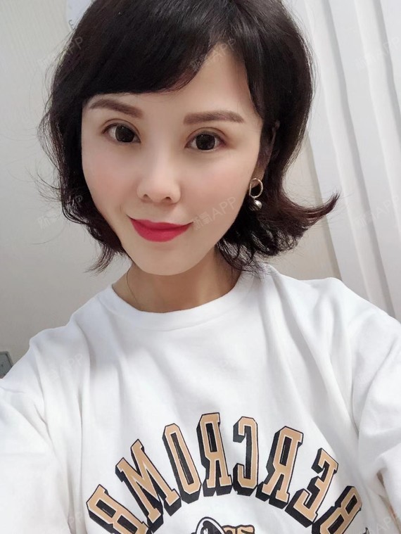 天空之墙眼部修复第40天美丽日记-新氧美容整