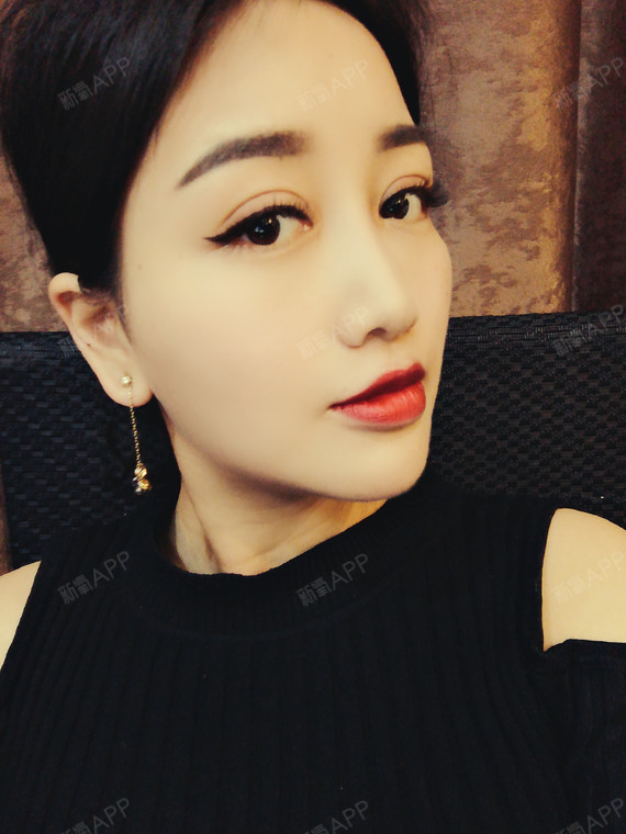 黎明前割个双眼皮切开双眼皮第131天美丽日记