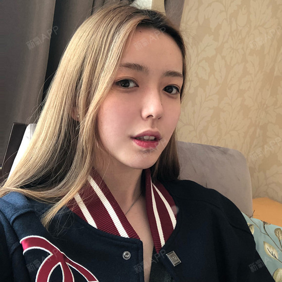 Leoyuu自体脂肪全脸填充第100天美丽日记-新