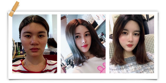 整形大咖郑宰昊博士亲临紫馨助力韩国整形节!