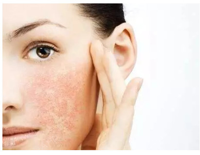 做激光美容,会使皮肤变薄吗?激光美容因为其效