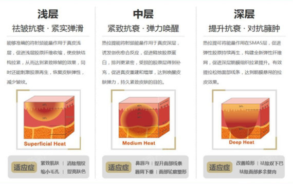 超声刀作用于真皮层之下的smars筋膜层,对于小可爱