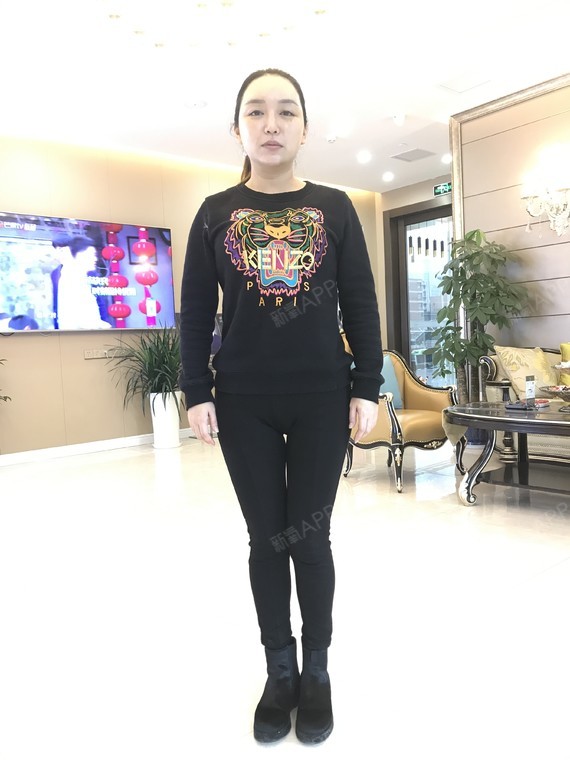 吸脂瘦全身好不好_效果图_哇哈哈哈哈哈hhh吸脂瘦全身术后第215天