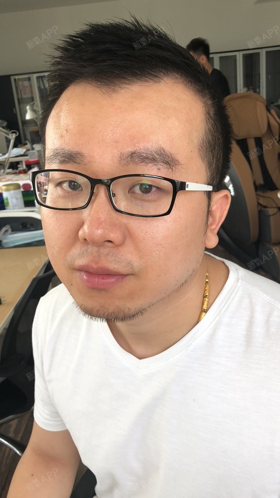 种植眉毛