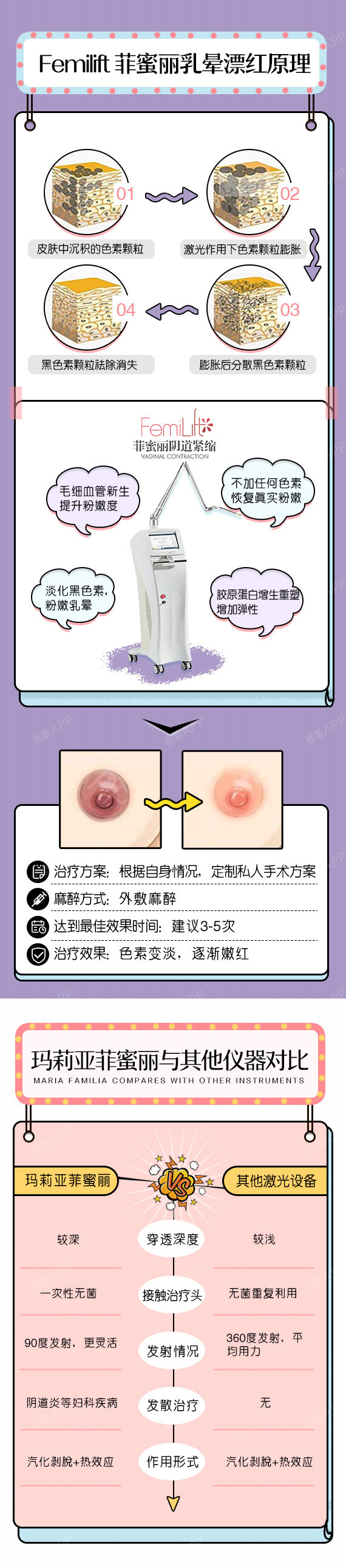 【乳晕漂红】【乳晕漂红】飞顿菲蜜丽激光,原公立医院