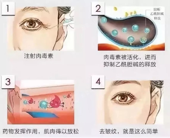 影响肩膀美感的关键因素在肩颈,就是斜方肌,这块肌肉位于上背及中背