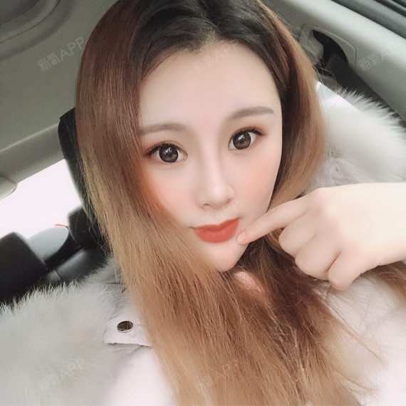 北京自体脂肪全脸填充好不好_效果图_艾莹莹自体脂肪全脸填充术后第20