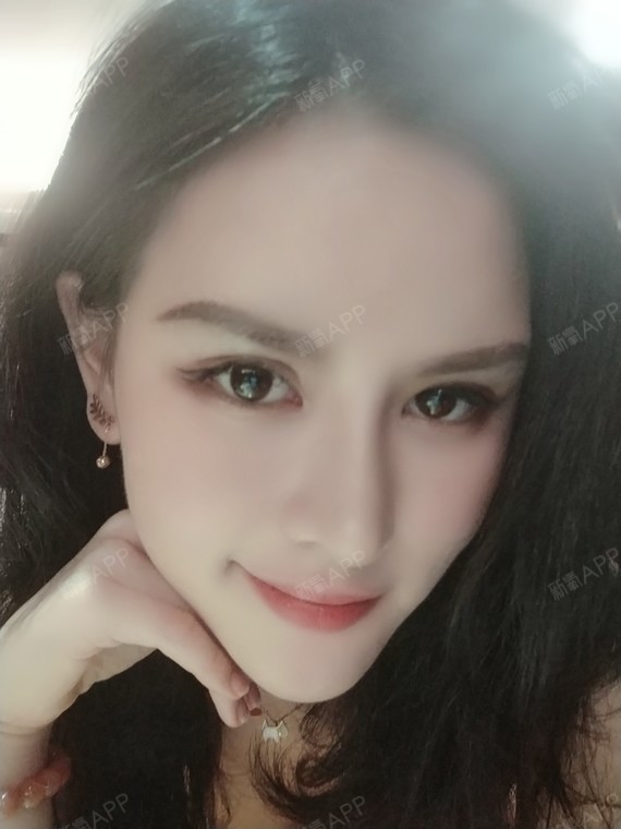 讲真的,眉骨这东西真的得配合你的整体五官来设计,医生说的对,一般动