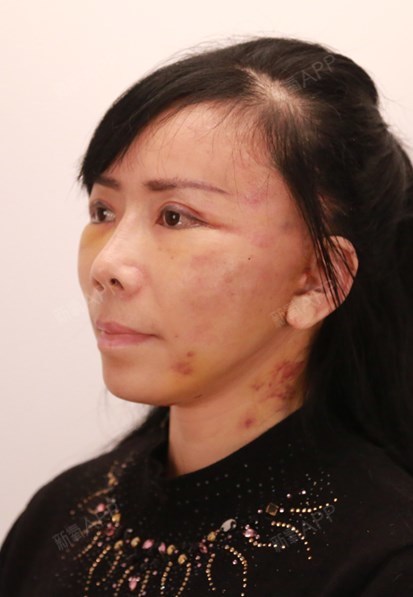 术后当自强