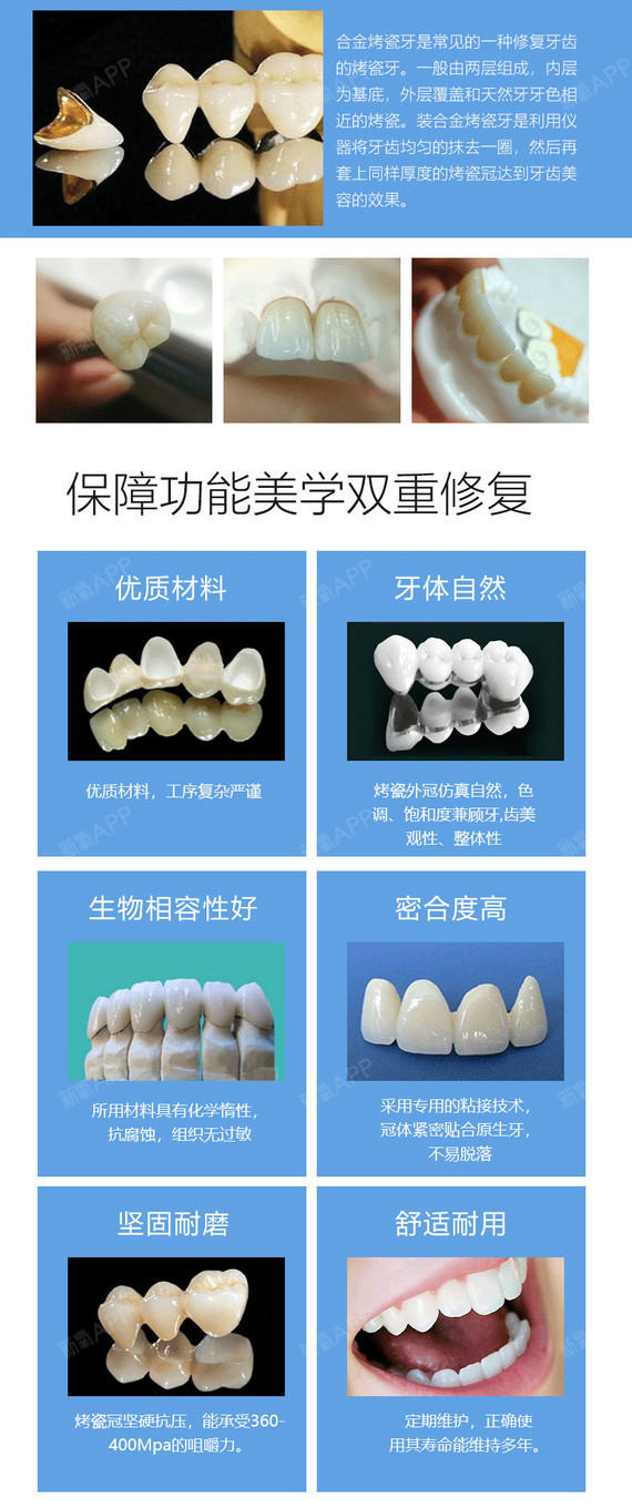 【合金烤瓷牙】华美钴铬合金烤瓷牙 680元/颗 美容冠