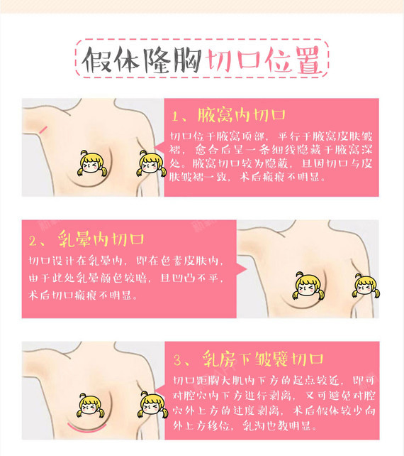 【假体隆胸】美国进口曼托假体隆胸,半球,手感真实,还