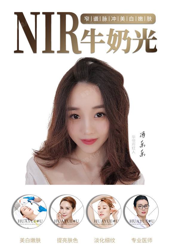 【光子嫩肤】飞顿nir美白牛奶光 美白淡斑 紧肤除皱 改善肤色 胶原