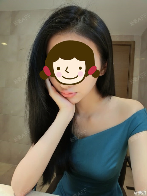 今天看到有的女性朋友在担心手术安全的问题,其实作为