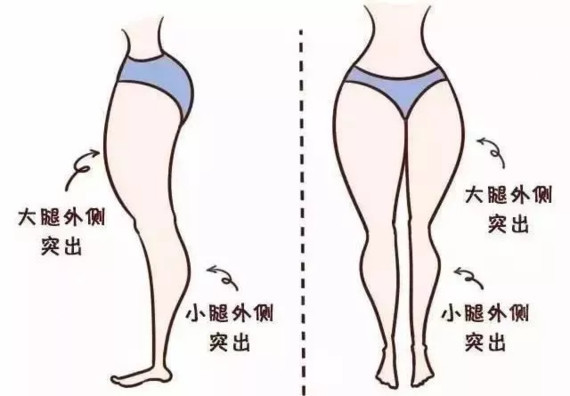 小粗腿理直气壮不存在,只因先生针打在这些点阮瘦腿瘦脸贴图片