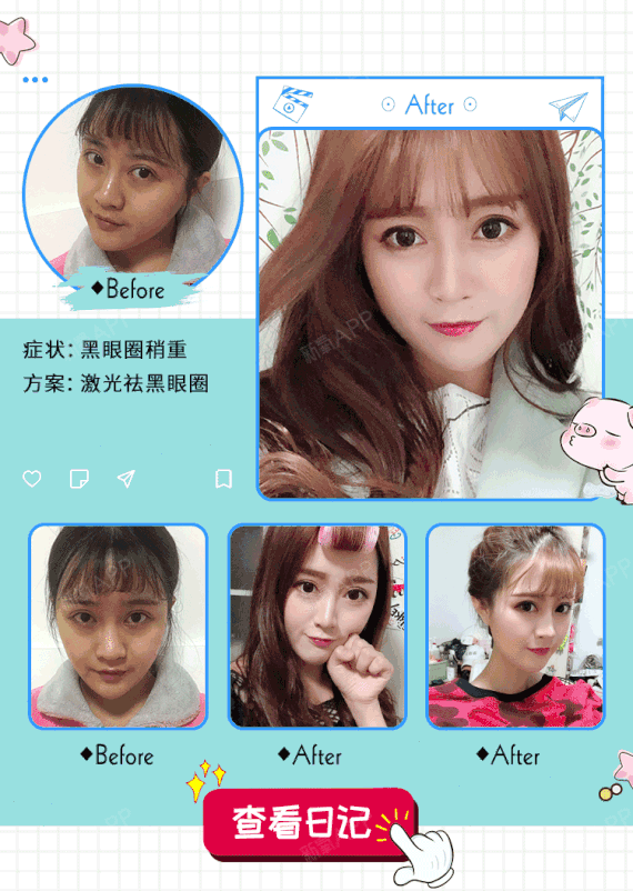 【激光去黑眼圈】【4倍充值·首单免费】激光祛黑眼圈