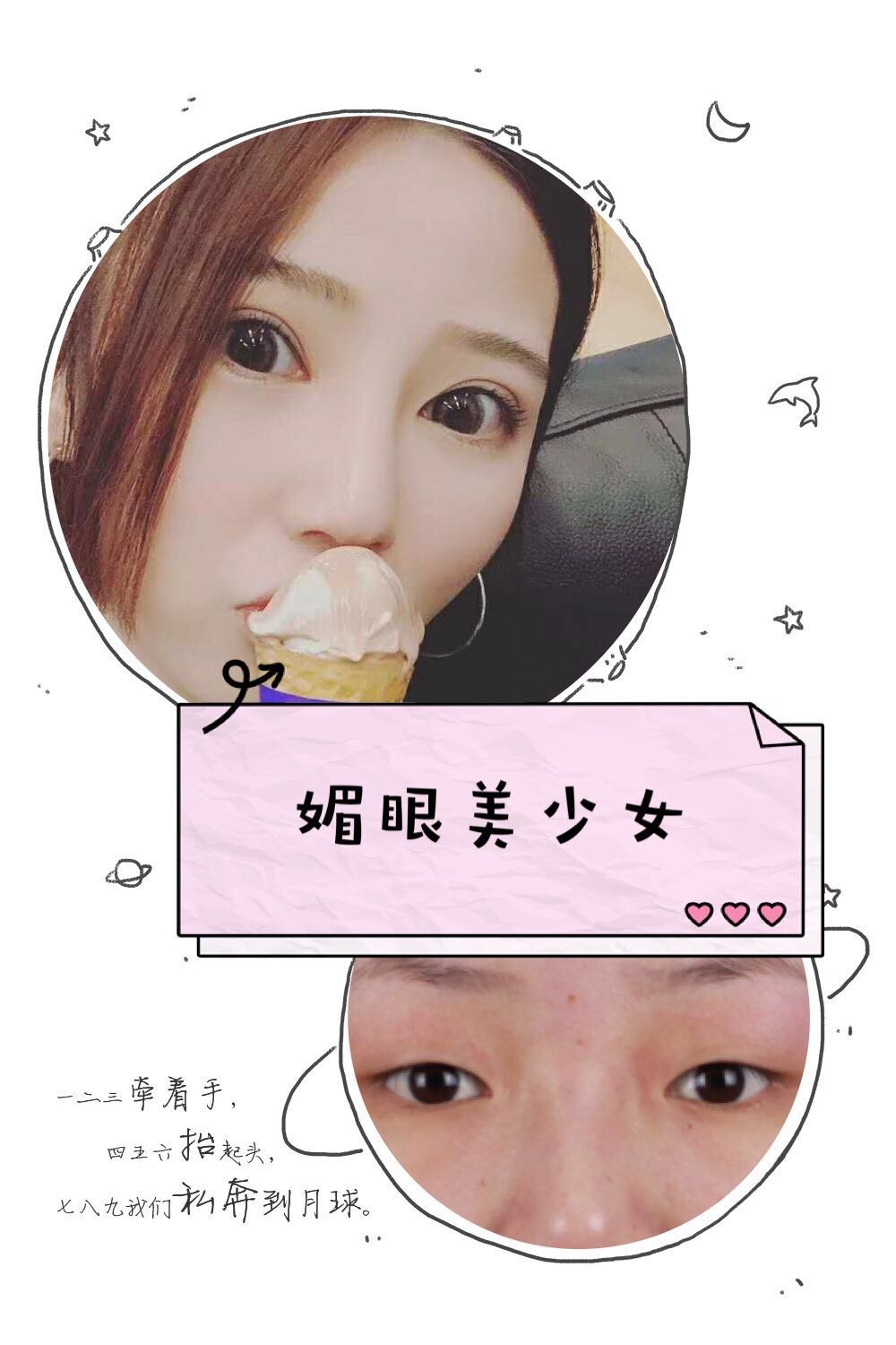 【科普】普通切开去脂vs肿泡眼矫正的区别