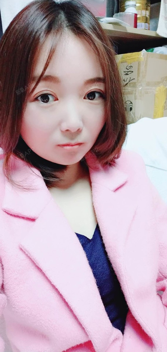 氧气ye36b眼部综合第120天美丽日记