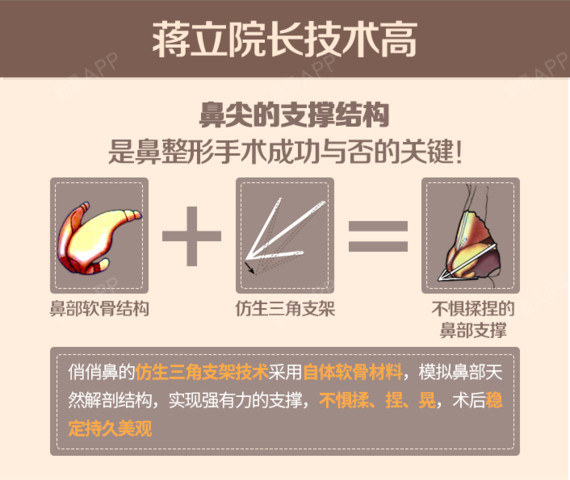 【肋软骨隆鼻】半肋软骨隆鼻#仿生三角支架#自然挺翘立体 稳固不惧