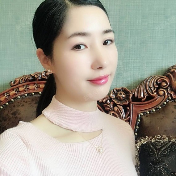 最后,价格呢也比较划算.所以确定做了隐适美.
