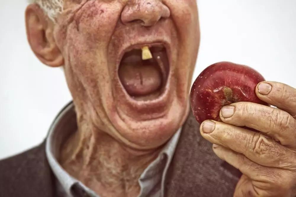 为什么老年人的牙齿容易发酸?