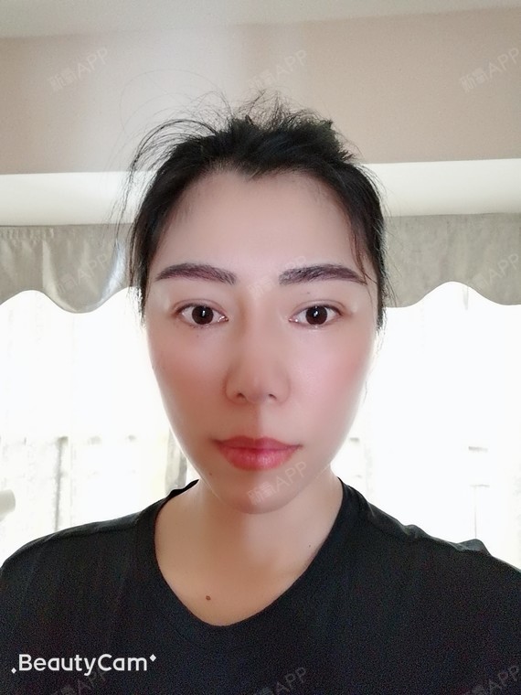 种植眉毛