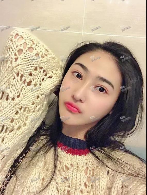术后心声 年轻人! 为什么要压抑自己内心真实的想法?