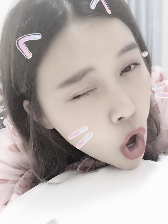 玻尿酸打下巴多久可以补针?