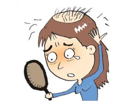 脱发治疗最好的时机是什么时候?