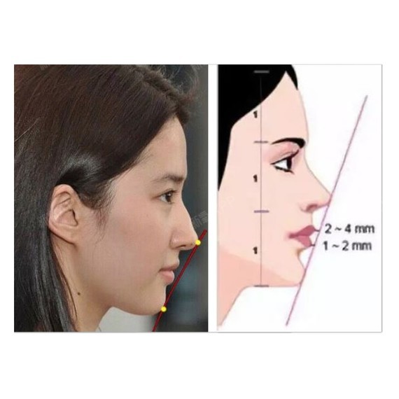 侧脸是否好看 主要是看骨相 也就是是我们下颌骨的发育状况与牙齿咬合