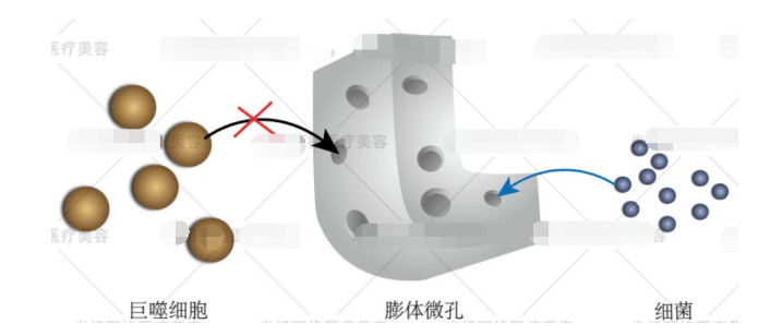 细菌可以进入膨体微孔,而巨噬细胞却不行