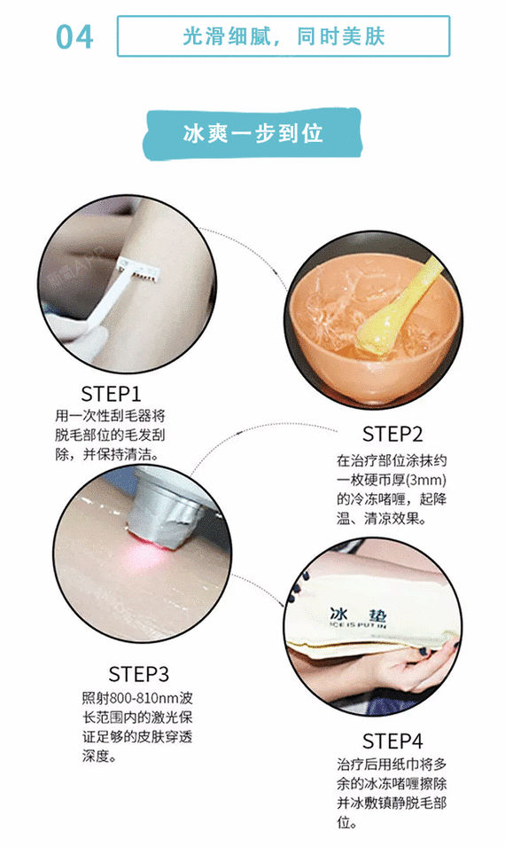 【激光脱毛】比基尼线脱毛 一年12次 ,【超冰脱毛】比基尼脱毛全年