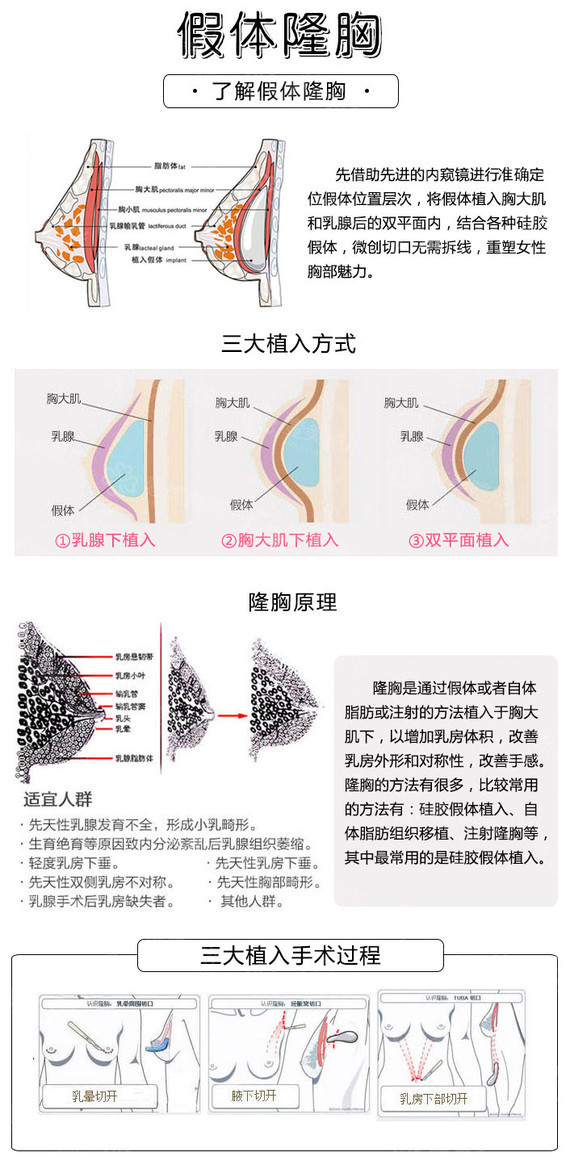 【假体隆胸】塑造男人爱摸的奶油大胸 水滴形/圆盘形