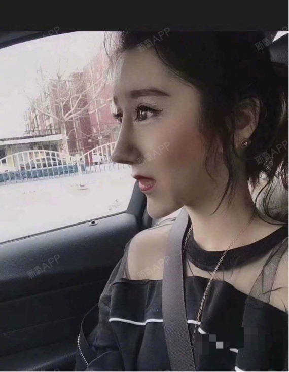 每年30000例"网红鼻"返厂重修,隆鼻死忠党该何去何从?