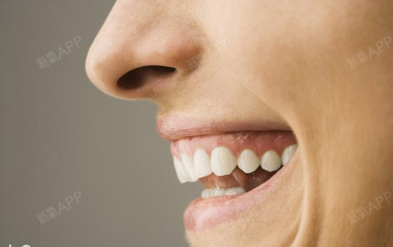 牙齿洁白的人一般不会出现牙结石等问题.