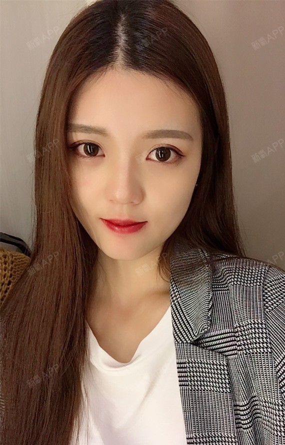 双眼皮修复的最佳时间是多久?