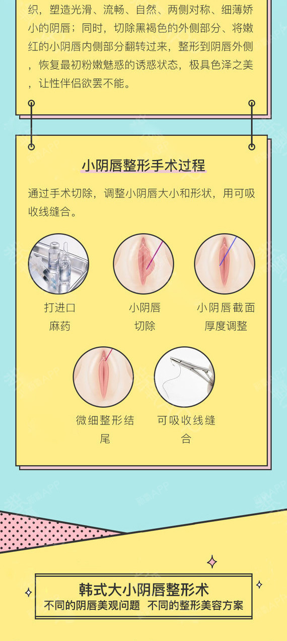 【小阴唇手术】私密紧致 外阴乳晕漂红 私处粉粉嫩嫩