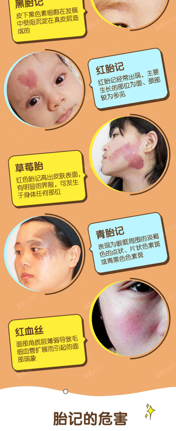 【激光祛疤】【激光祛胎记】 1cm 轻松去除先天瑕疵,重新谱写美丽人生