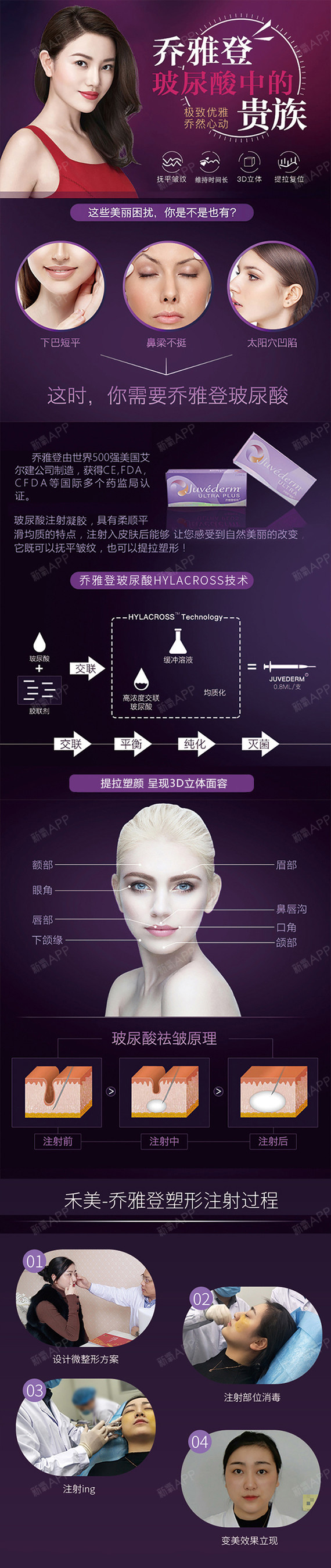 商品详情 项目价格表 项目名称项目组合医生/级别新氧价 乔雅登极致