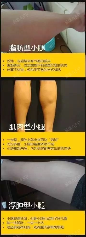 从短粗胖到"腿玩年",瘦腿针能让你的大象腿发生多大的改变?